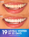 Crest 3D Whitestrips Professional Effects Level 19 - Pearly Whites UK