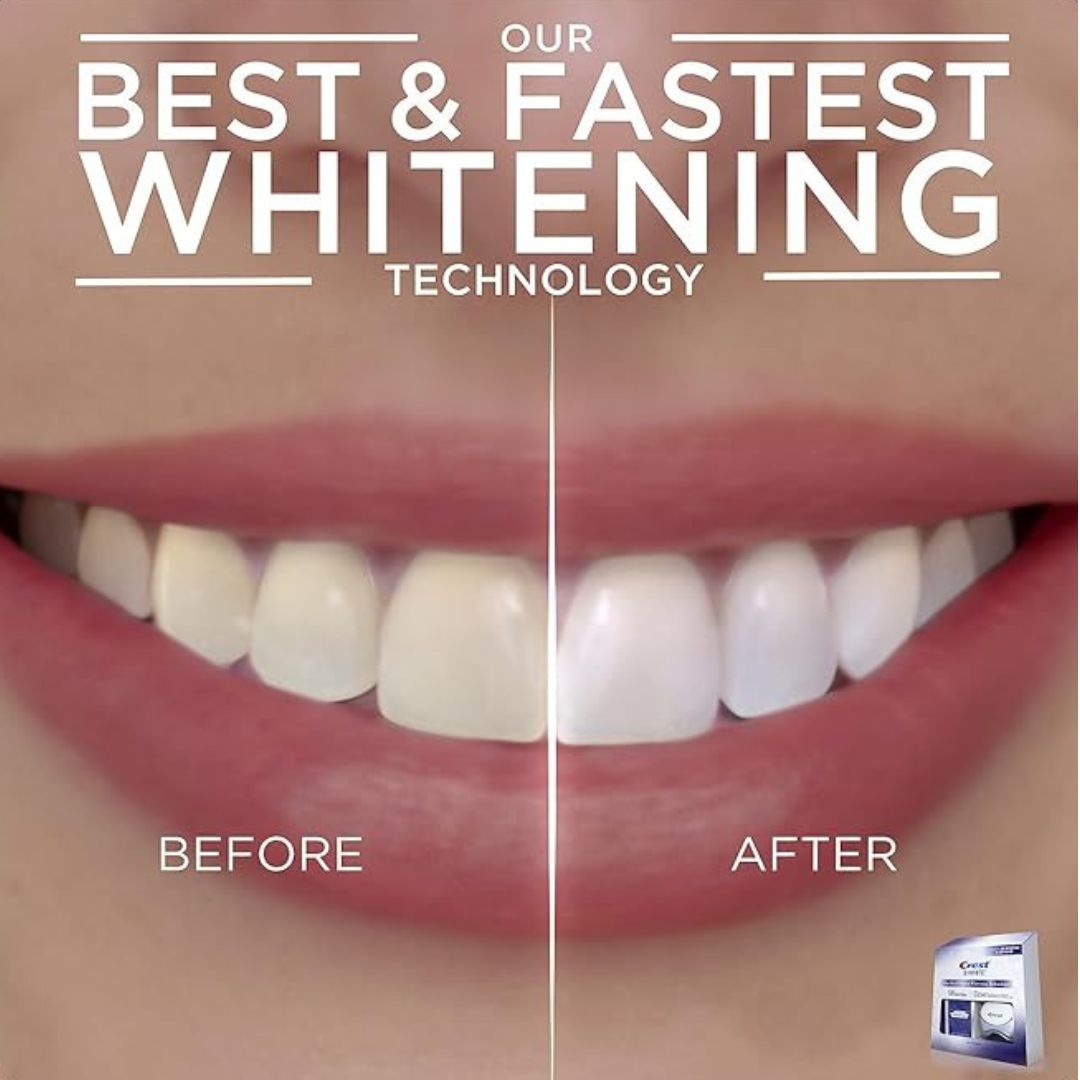 Crest 3D Whitestrips with Light - Pearly Whites UK