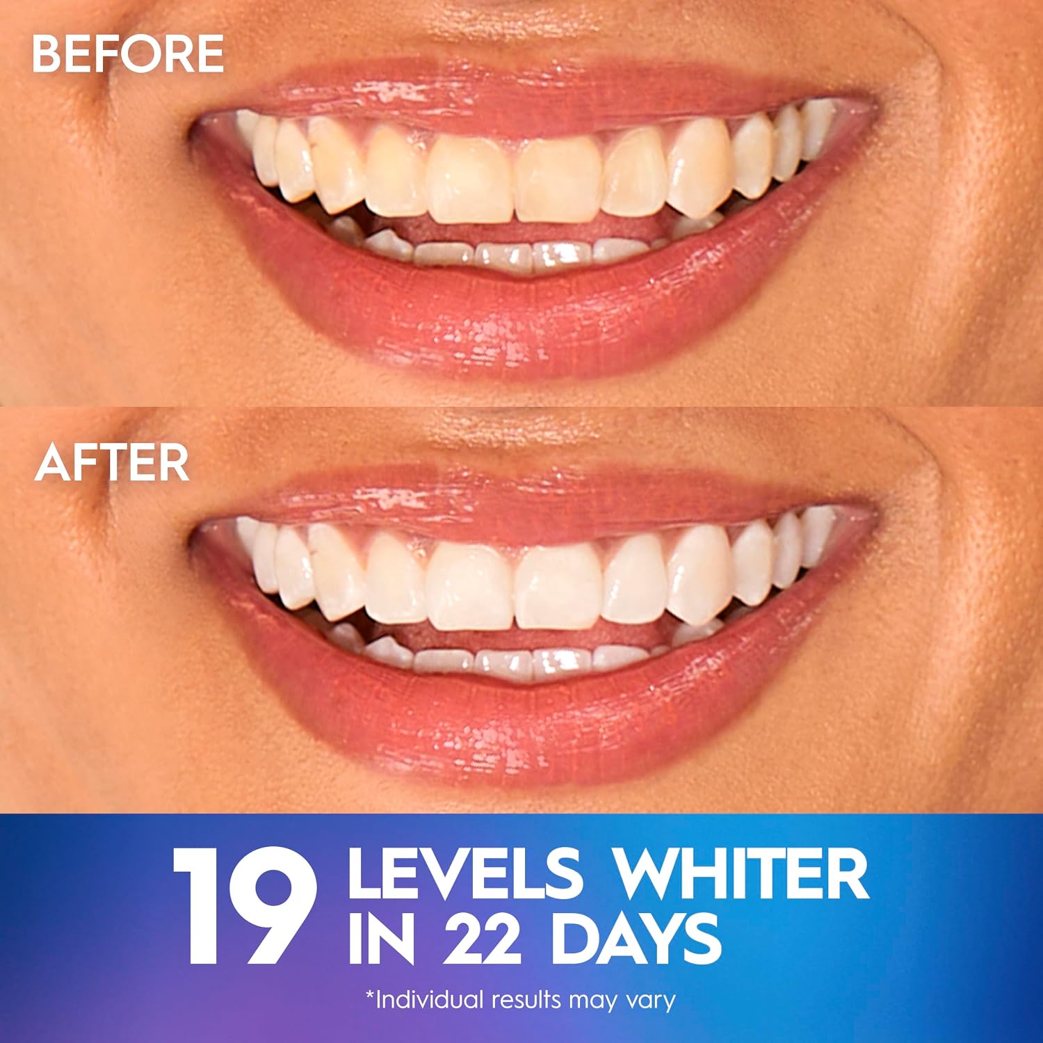 Crest 3D Whitestrips Professional Effects Level 19 - Pearly Whites UK